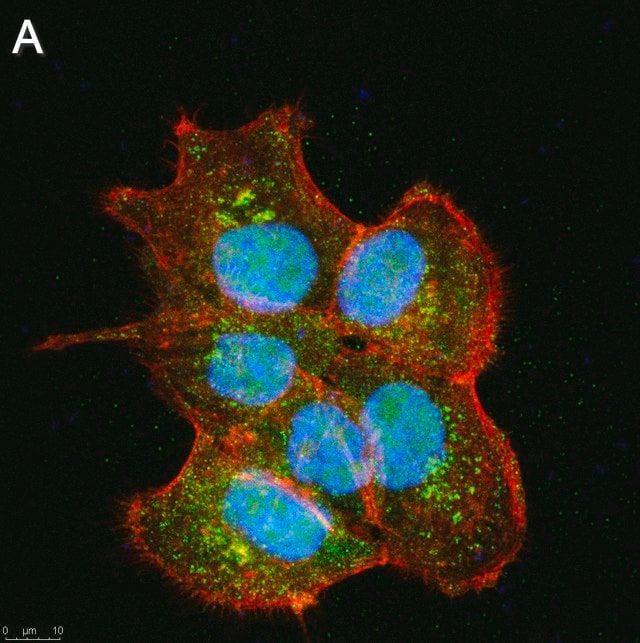 Anti-SIRT6 Antibody, clone 1O6 ZooMAb<sup>®</sup> Rabbit Monoclonal