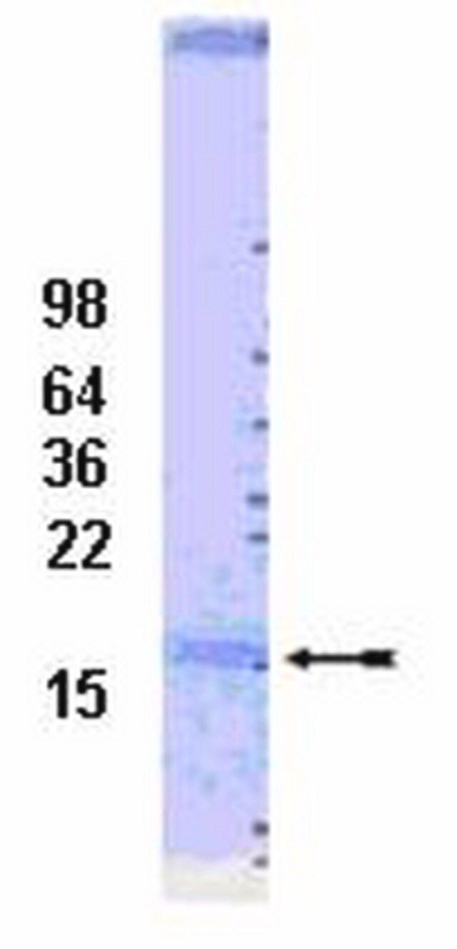 UbcH7 Conjugating Enzyme, 100 μg