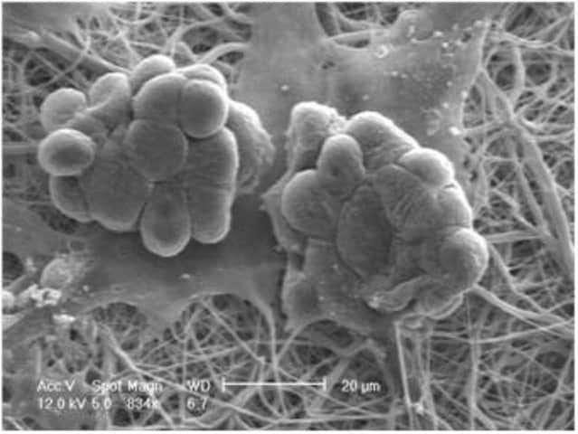 Nanofiber multiwell plate inserts, with random oriented nanofibers