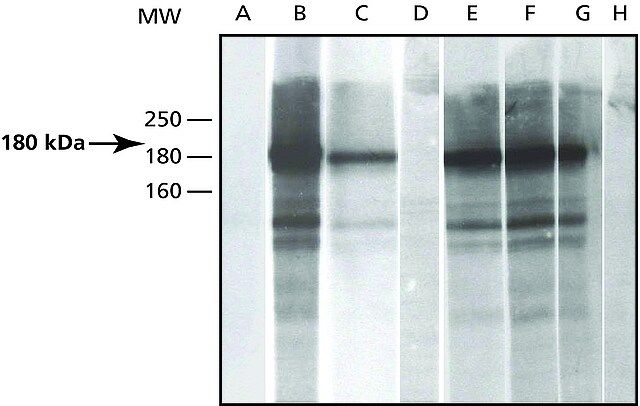 Anti-Phosphotyrosine antibody produced in rabbit