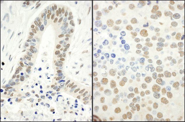 Rabbit anti-Phospho RPA32 (S4/S8) Antibody, Affinity Purified