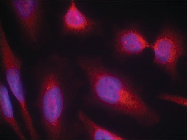 Anti-MAPT (Ab-214) antibody produced in rabbit
