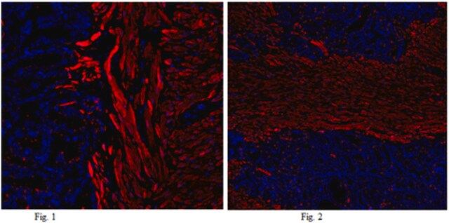 Anti-Calponin-1 Antibody