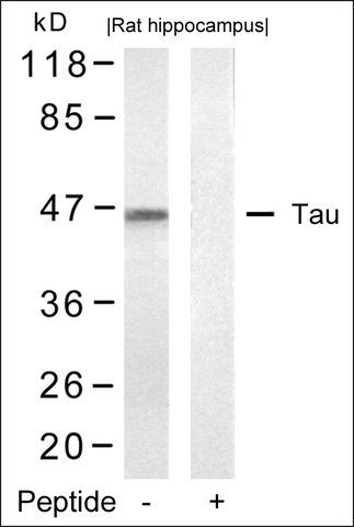 Anti-MAPT (Ab-422) antibody produced in rabbit
