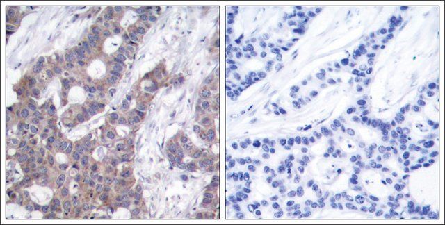 Anti-phospho-STMN1 (pSer<sup>16</sup>) antibody produced in rabbit