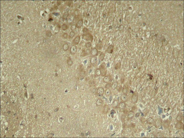 Anti-phospho-MAPT (pSer<sup>262</sup>) antibody produced in rabbit
