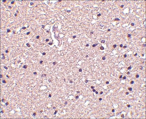 Anti-Op18 (ab2) antibody produced in rabbit