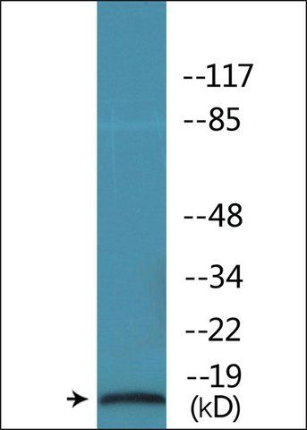 Anti-phospho-STMN1 (pSer<sup>62</sup>) antibody produced in rabbit