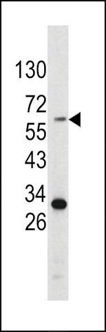 ANTI-TYROSINASE(C-TERMINAL) antibody produced in rabbit