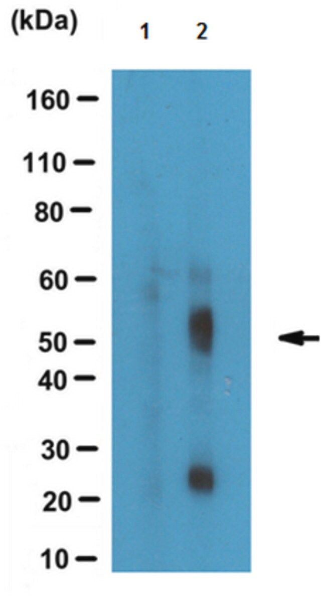 Anti-phospho Tau (Thr181), clone 1E7 Antibody