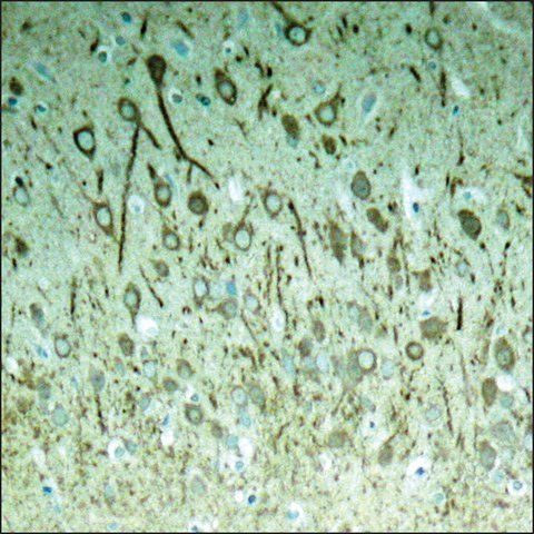 Anti-phospho-MAPT (pThr<sup>231</sup>) antibody produced in rabbit