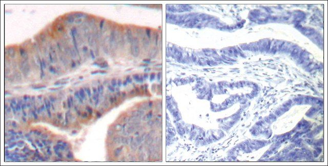 Anti-STMN1 (Ab-62) antibody produced in rabbit