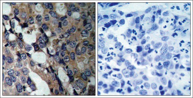 Anti-HSPB1 (Ab-15) antibody produced in rabbit