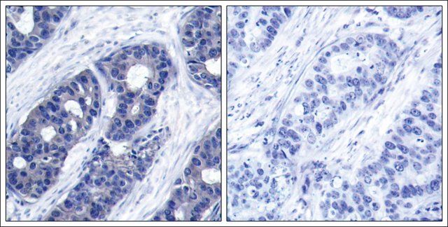Anti-IRS1 (Ab-636) antibody produced in rabbit