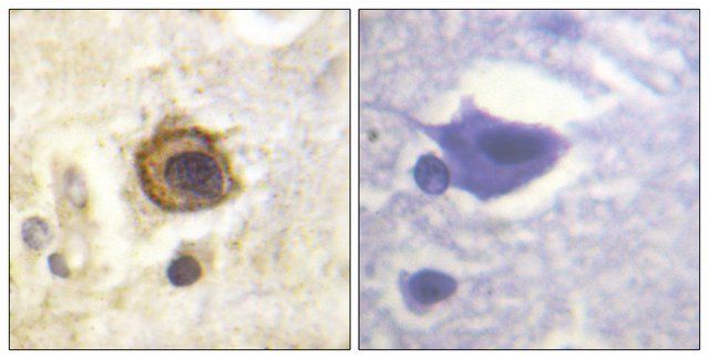 Anti-PDGFR β antibody produced in rabbit
