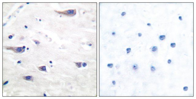 Anti-PDGF Receptor β antibody produced in rabbit