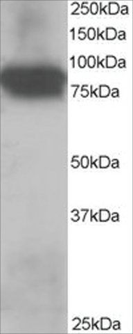 Anti-Plakoglobin/γ-Catenin antibody produced in goat