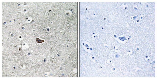 Anti-PKC δ antibody produced in rabbit