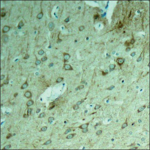 Anti-MAPT (Ab-231) antibody produced in rabbit