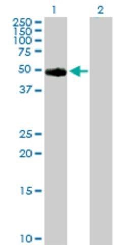 Anti-TYR antibody produced in rabbit