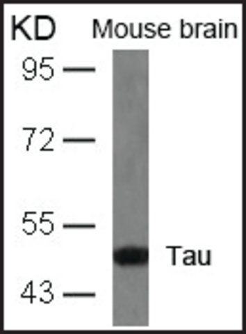 Anti-MAPT (Ab-404) antibody produced in rabbit