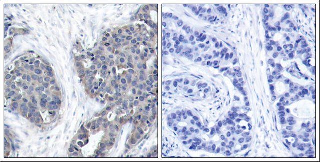 Anti-STMN1 (Ab-38) antibody produced in rabbit