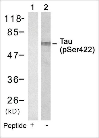 Anti-phospho-MAPT (pSer<sup>422</sup>) antibody produced in rabbit