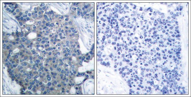 Anti-STMN1 (Ab-25) antibody produced in rabbit