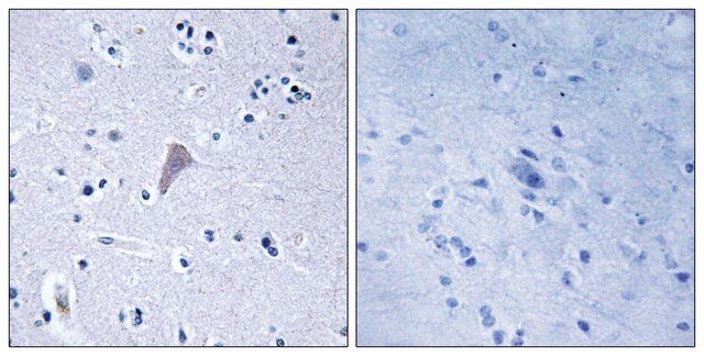 Anti-MTOR antibody produced in rabbit
