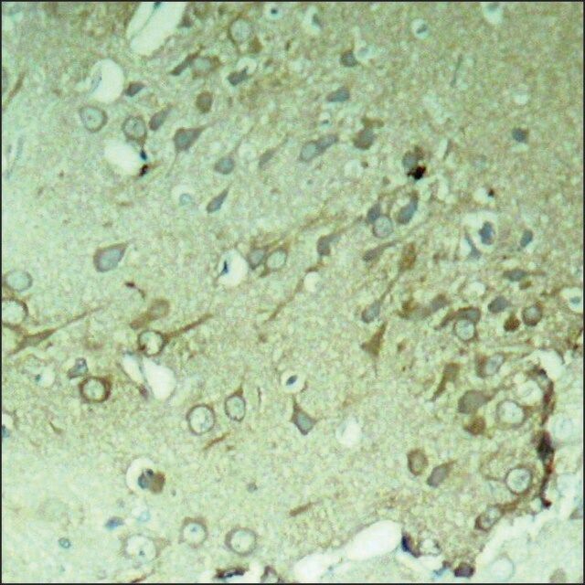 Anti-MAPT (Ab-396) antibody produced in rabbit