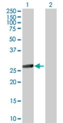 ANTI-IKBKB antibody produced in mouse