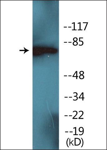 Anti-phospho-PKC δ (pTyr<sup>52</sup>) antibody produced in rabbit