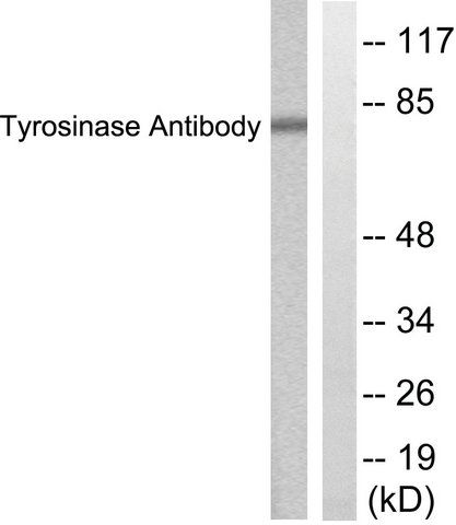 Anti-Tyrosinase antibody produced in rabbit