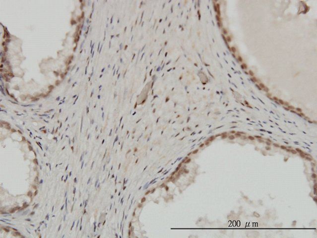 Monoclonal Anti-ZNF202 antibody produced in mouse