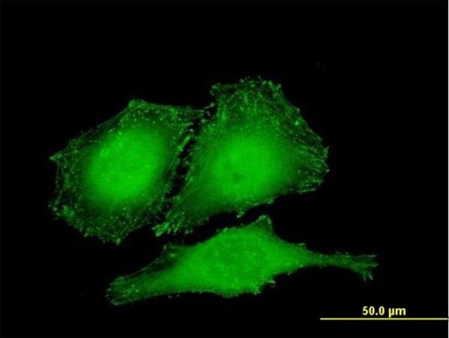 Monoclonal Anti-ZYX antibody produced in mouse