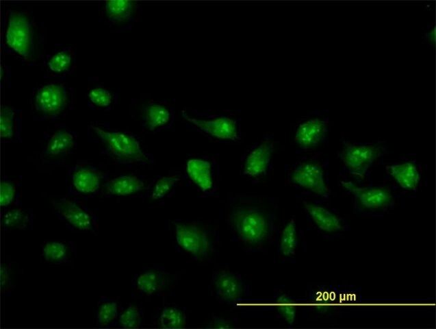 Monoclonal Anti-ZIC4 antibody produced in mouse