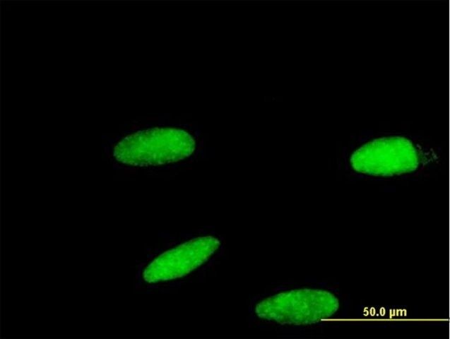Monoclonal Anti-ZNF587 antibody produced in mouse