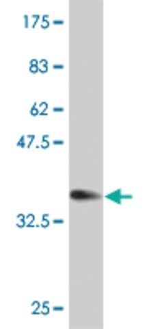 Monoclonal Anti-ZNF155 antibody produced in mouse
