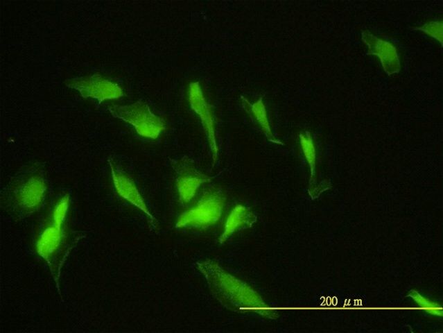 Monoclonal Anti-ZNF174 antibody produced in mouse