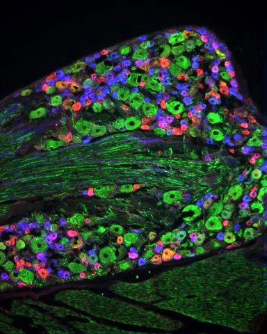 Anti-Neurofilament 160/200 antibody, Mouse monoclonal antibody produced in mouse