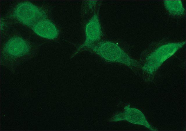 Anti-NR4A2 antibody produced in rabbit