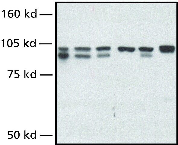 Anti-NBS1 (Nibrin) antibody produced in rabbit
