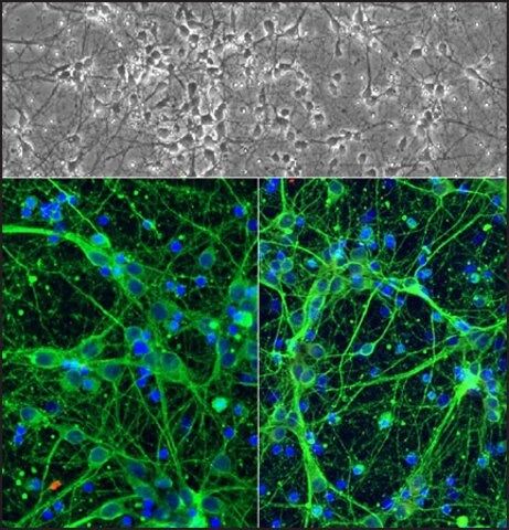 Rat Cortical Neurons: RCoN