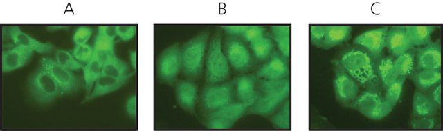 Anti-<i>O</i>-GlcNAc Transferase (TI-14) antibody produced in rabbit