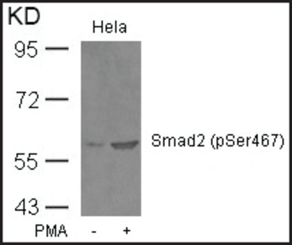 Anti-phospho-SMAD2 (pSer<sup>467</sup>) antibody produced in rabbit
