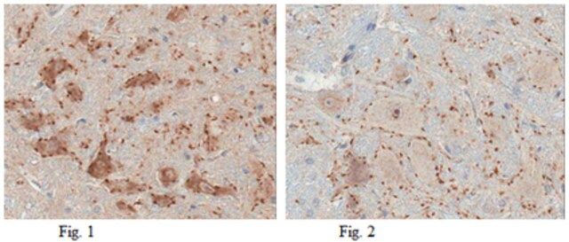 Anti-Vesicular Acetylcholine Transporter (VAChT) Antibody