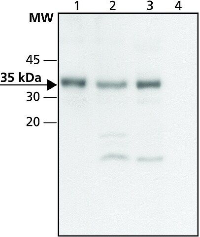 Anti-CHIP (C-terminal) antibody produced in rabbit