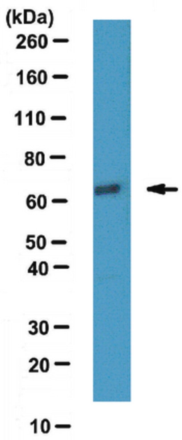 Anti-ATDC Antibody