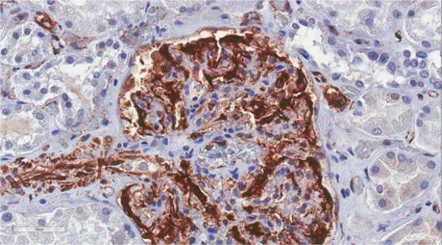 Anti-Wilms′ Tumor Antibody, NT clone 6F-H2, Ascites Free