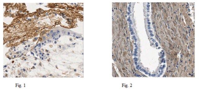 Anti-Fibronectin (Cell Attachment Fragment) Antibody, clone 3E3, Ascites &Azide Free